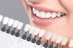 Cosmetic dental Services